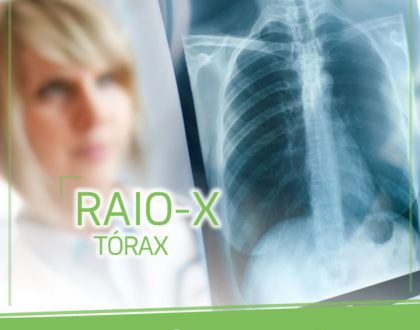 Raio-X de Tórax